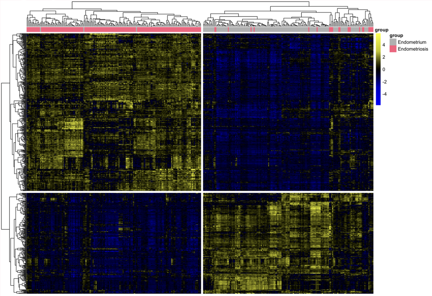 Gene Expression Data Analysis of Endometriosis